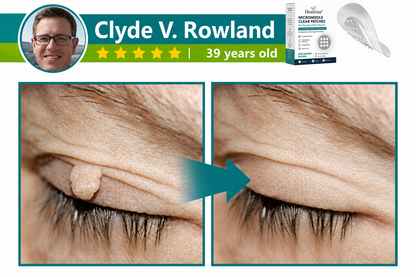 💞💞🇬🇧𝐇𝐞𝒂𝒍𝗿𝗶𝙯𝙚®2-in-1 Microneedle & Hydrocolloid Patch🛡️| Removes Raised Moles, Acne, Flat Warts & Skin Tags | Helps Improve Wrinkles, Scars & Blemishes | Invisible Patches for Face & Body