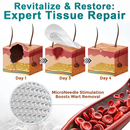💞💞🇬🇧𝐇𝐞𝒂𝒍𝗿𝗶𝙯𝙚®2-in-1 Microneedle & Hydrocolloid Patch🛡️| Removes Raised Moles, Acne, Flat Warts & Skin Tags | Helps Improve Wrinkles, Scars & Blemishes | Invisible Patches for Face & Body