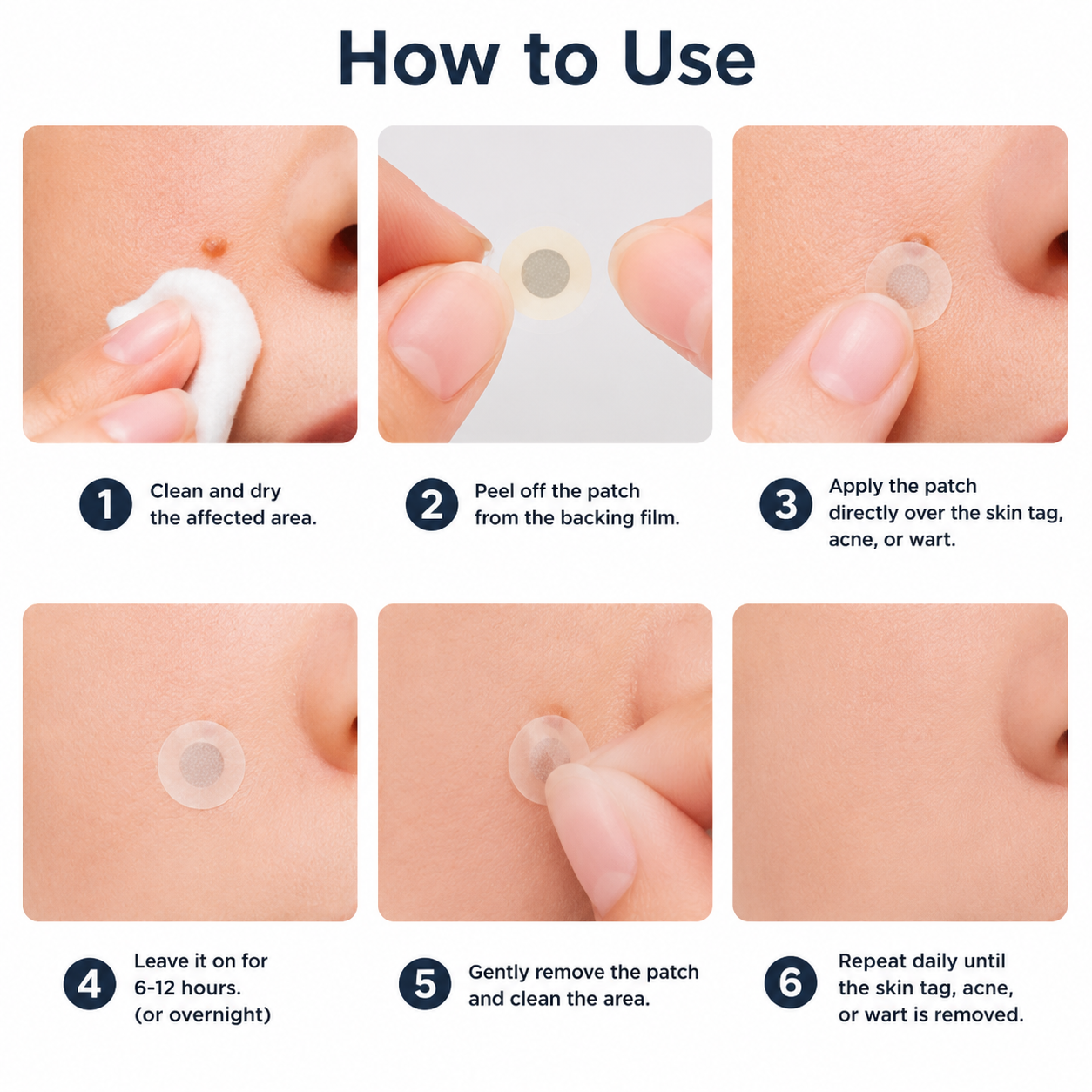 💞💞🇬🇧𝐇𝐞𝒂𝒍𝗿𝗶𝙯𝙚®2-in-1 Microneedle & Hydrocolloid Patch🛡️| Removes Raised Moles, Acne, Flat Warts & Skin Tags | Helps Improve Wrinkles, Scars & Blemishes | Invisible Patches for Face & Body