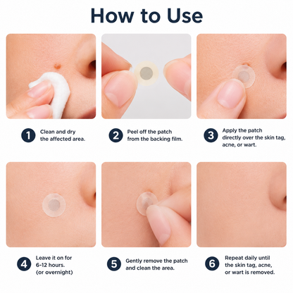💞💞🇬🇧𝐇𝐞𝒂𝒍𝗿𝗶𝙯𝙚®2-in-1 Microneedle & Hydrocolloid Patch🛡️| Removes Raised Moles, Acne, Flat Warts & Skin Tags | Helps Improve Wrinkles, Scars & Blemishes | Invisible Patches for Face & Body